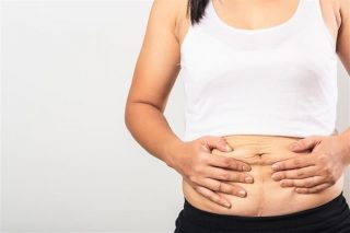 متى يتوقف خروج سوائل جرح شد البطن بعد العملية؟